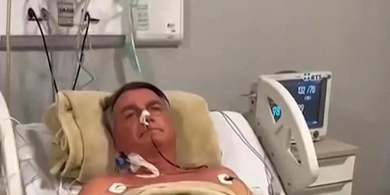 nternado desde o último dia 13, quando passou por cirurgia no intestino e na parede abdominal, o ex-presidente Jair Bolsonaro apresentou piora clínica, de acordo com boletim médico divulgado nesta quinta-feira (24) pelo Hospital DF Star.￼