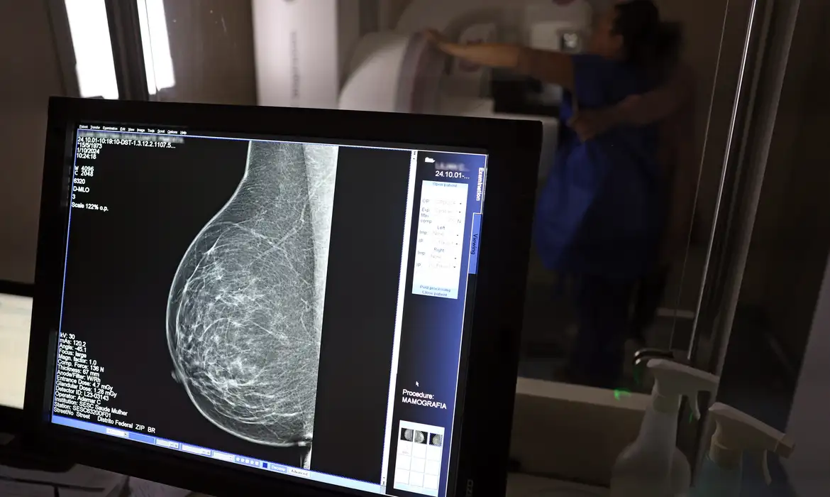 Dados do Painel Oncologia Brasil, analisados pelo Colégio Brasileiro de Radiologia e Diagnóstico por Imagem (CBR), indicam que mais de 108 mil mulheres com menos de 50 anos foram diagnosticadas com câncer de mama no Brasil no período entre 2018 e 2023 – uma média de uma em três mulheres diagnosticadas com a doença.